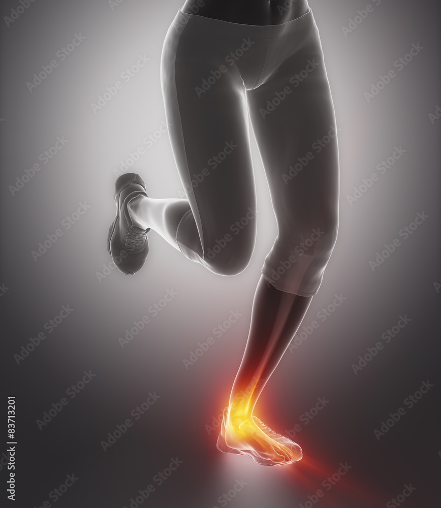 Ankle pain concept Ankle pain concept