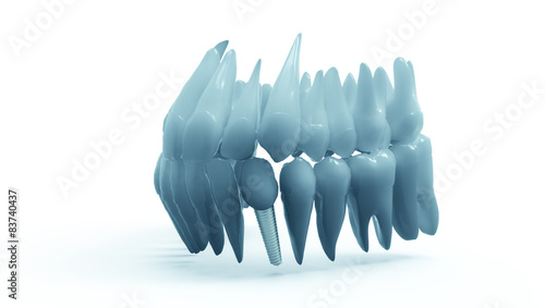 Dental implant on white background