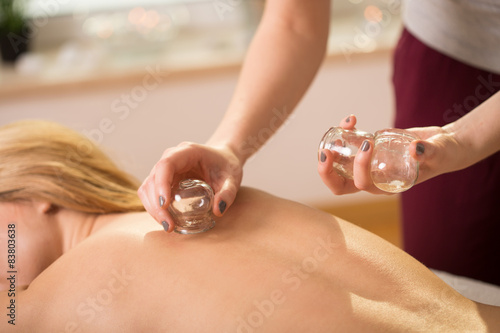Cupping therapy photo