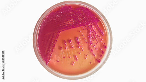 Agar plate with microorganisms on white background