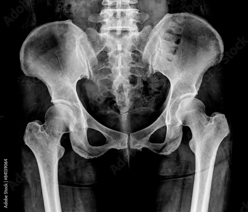 Fotografía sceme of the pelvis, back and spine