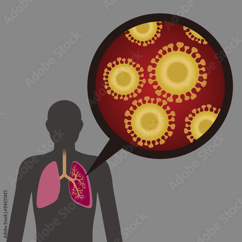Virus disease image illustration