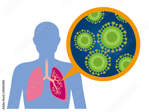 Virus disease image illustration