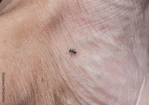 Mosquito bites on leg in the wild