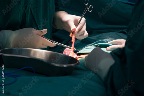 appendectomy