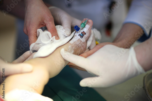 Inserting a catheter in the baby's leg