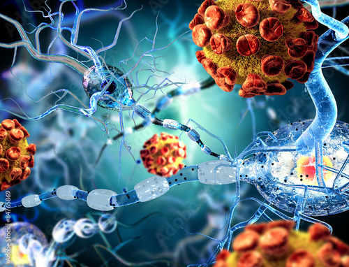 Schilderij op canvas 3d illustration of nerve cells, concept for Neurological Diseases, tumors and brain surgery
