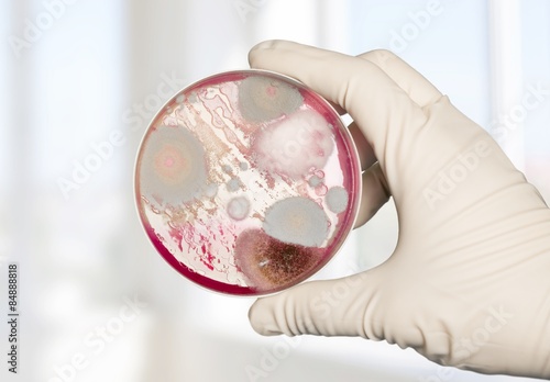 Petri, dish, enterococcus. photo