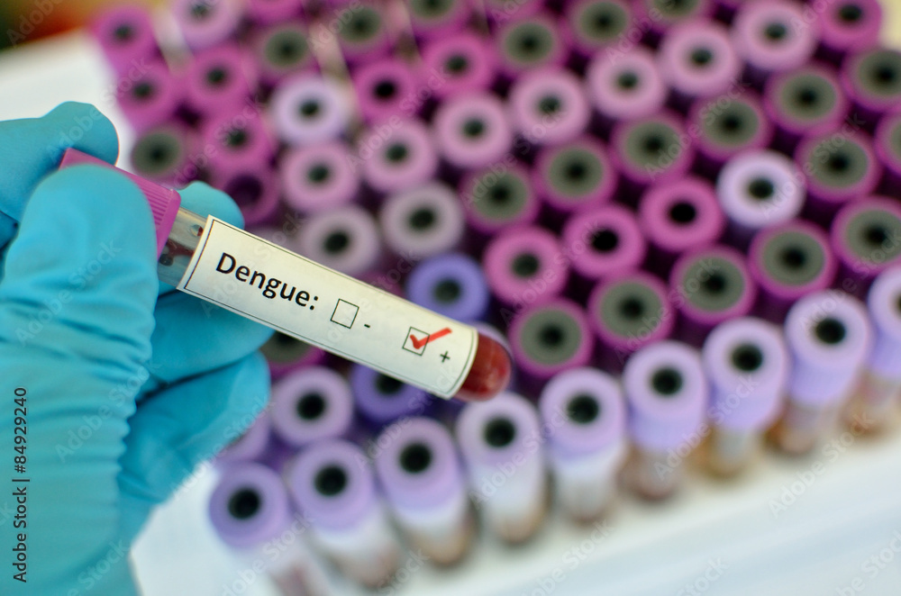 Obraz premium Blood sample with Dengue virus positive