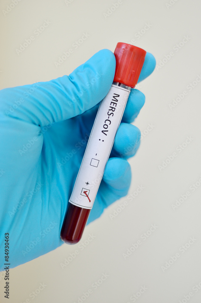 Naklejka premium MERS-CoV positive
