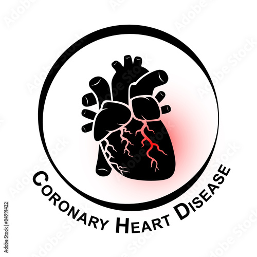 Coronary Heart Disease Symbol ( Ischemic heart disease , Myocardial infraction ) red area at coronary artery ( Thrombus occlude in coronary artery )