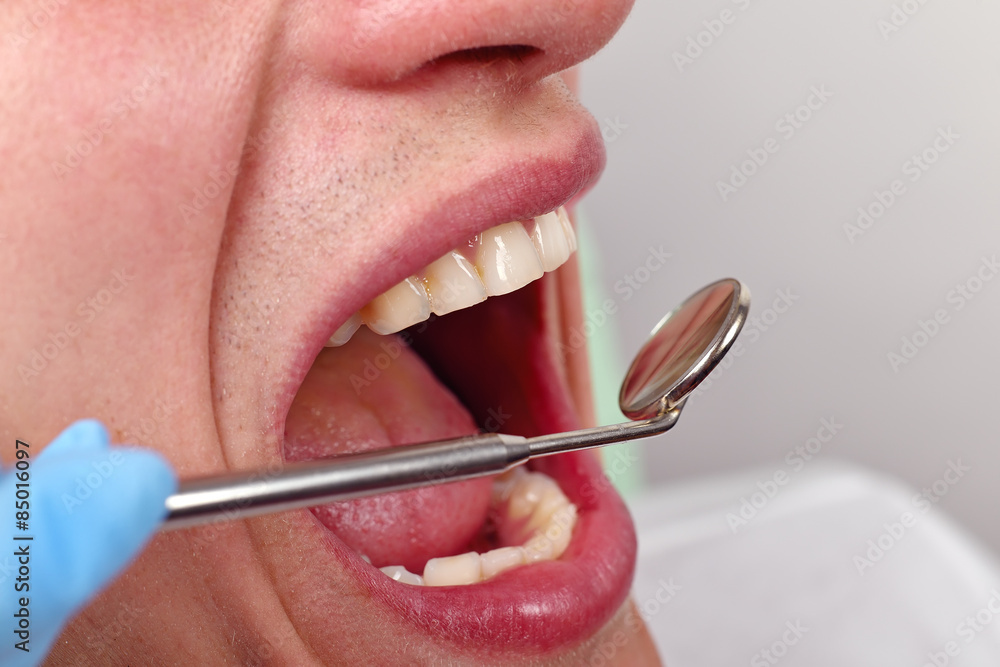 Obraz premium The dentist inserts the swab