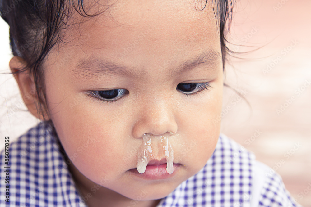 little-girl-with-snot-flowing-from-her-nose-stock-foto-adobe-stock