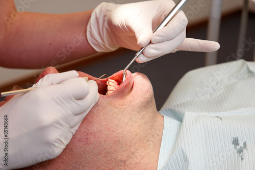 close up of a man getting his teeth checked by the  hygienist