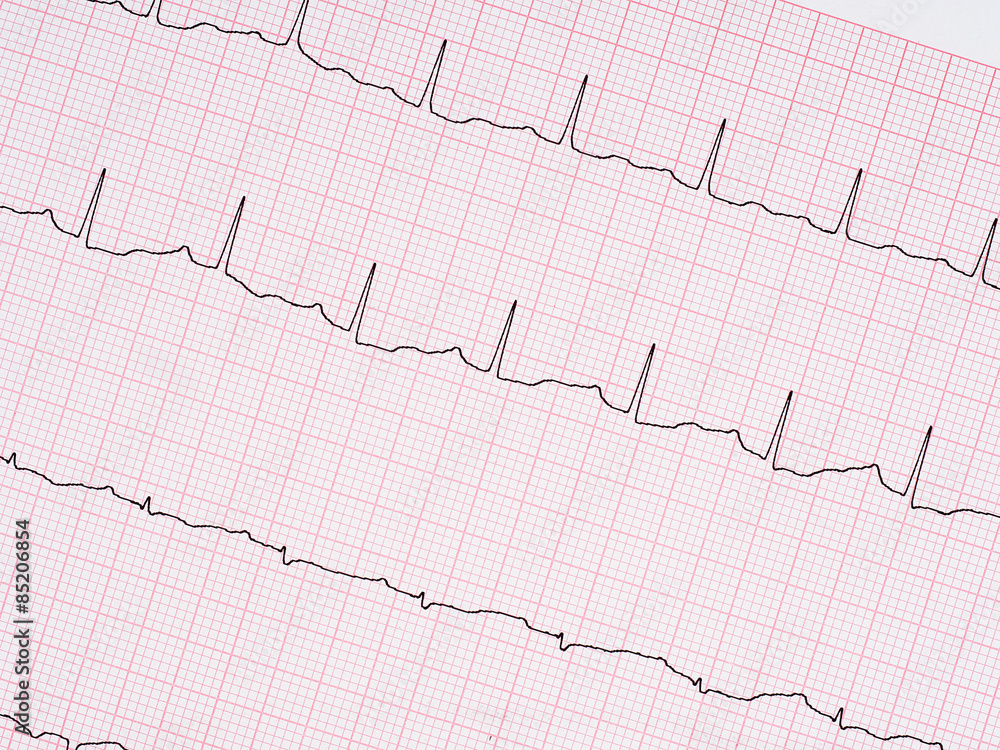 Electrocardiogram, ECG detail.