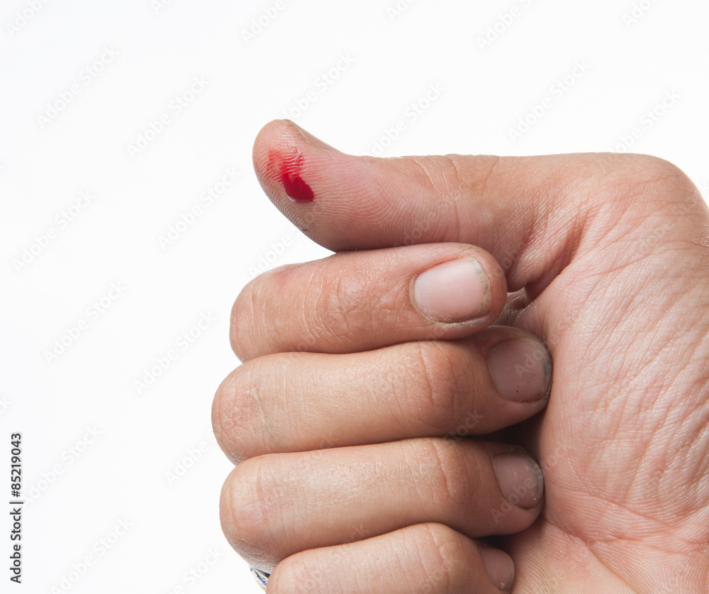 wounded finger with blood dripping isolated on white wounded finger with blood dripping isolated on white