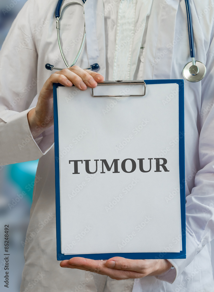 Doctor holds clipboard with tumour diagnosis Doctor holds clipboard with tumour diagnosis