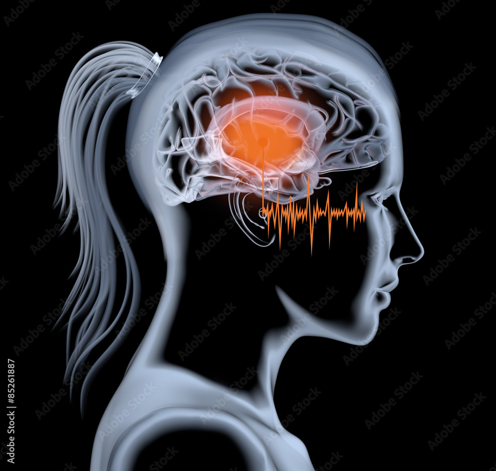 Fototapeta premium Tinnitus einer Frau, 3D Illustration