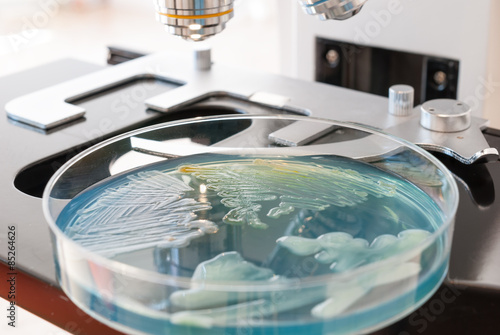 Petri dish infected with bacteria under the light of the laboratory microscope. Medical laboratory concept