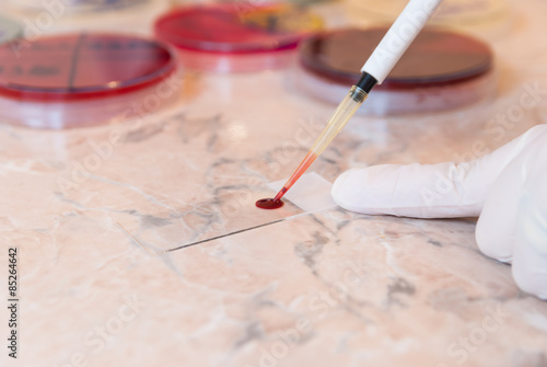 Laboratory doctor or scientific researcher preparing for a smear test or blood film. Using a pipette the doctor will put a drop of blood on the sterile slide
