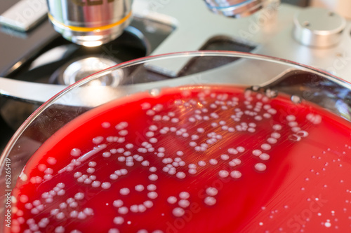 Bacteria colonies on petri dishes on microscope background