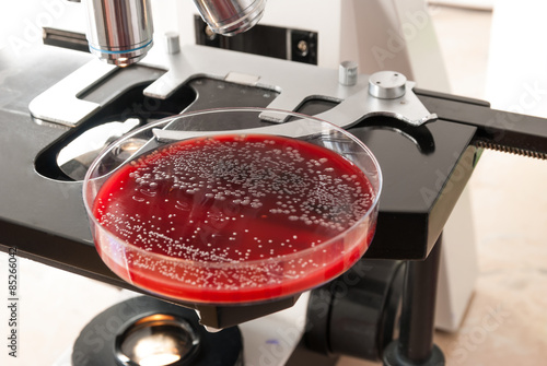 Petri dish with Escherichia Colli bacteria on microscope background