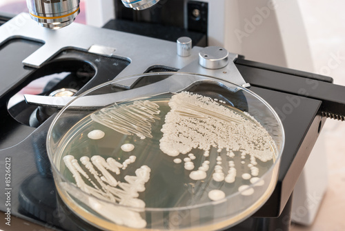 Petri dish with fungus on laboratory microscope. Candida albicans fungus on agar dish photo