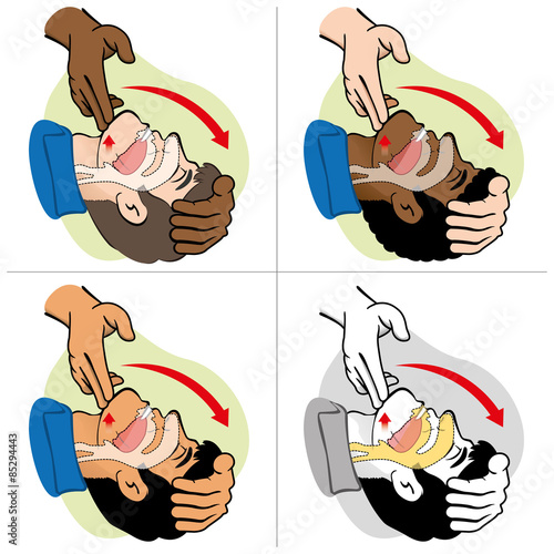 First Aid resuscitation (CPR), clearing breathing, positioning ethnicities
