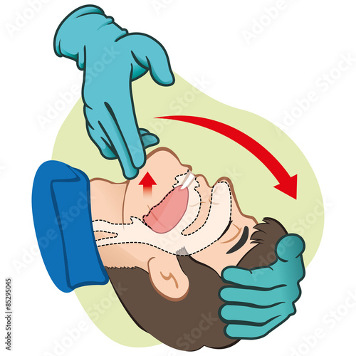 First Aid resuscitation (CPR), clearing breathing, positioning with gloves