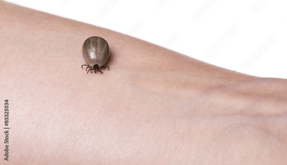 Obraz premium Tick on a skin