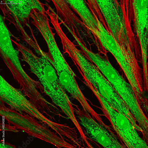 Fibroblasts (skin cells) labeled with fluorescent dyes