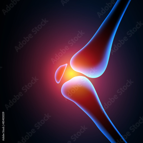 Painful Knee, easy all editable