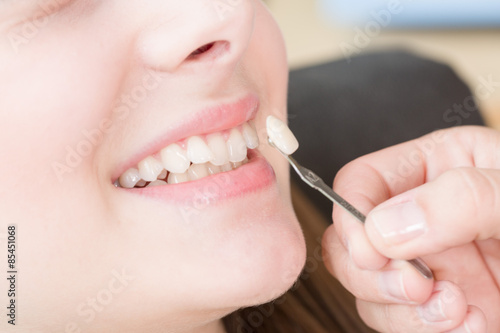 Beim Zahnarzt: Zahnfarbe für Krone vergleichen