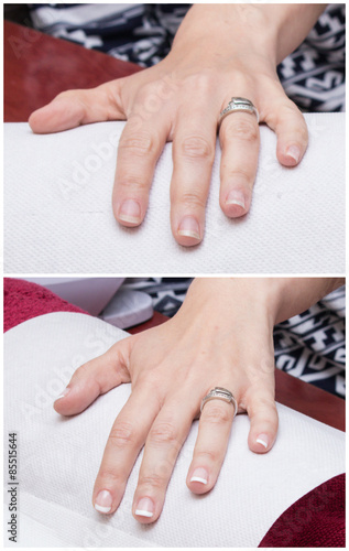 French manicure - before and after