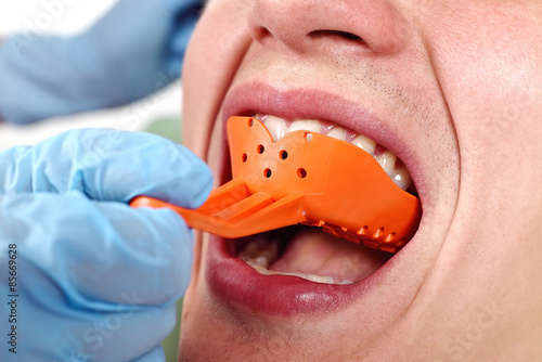 dentist inserts blade