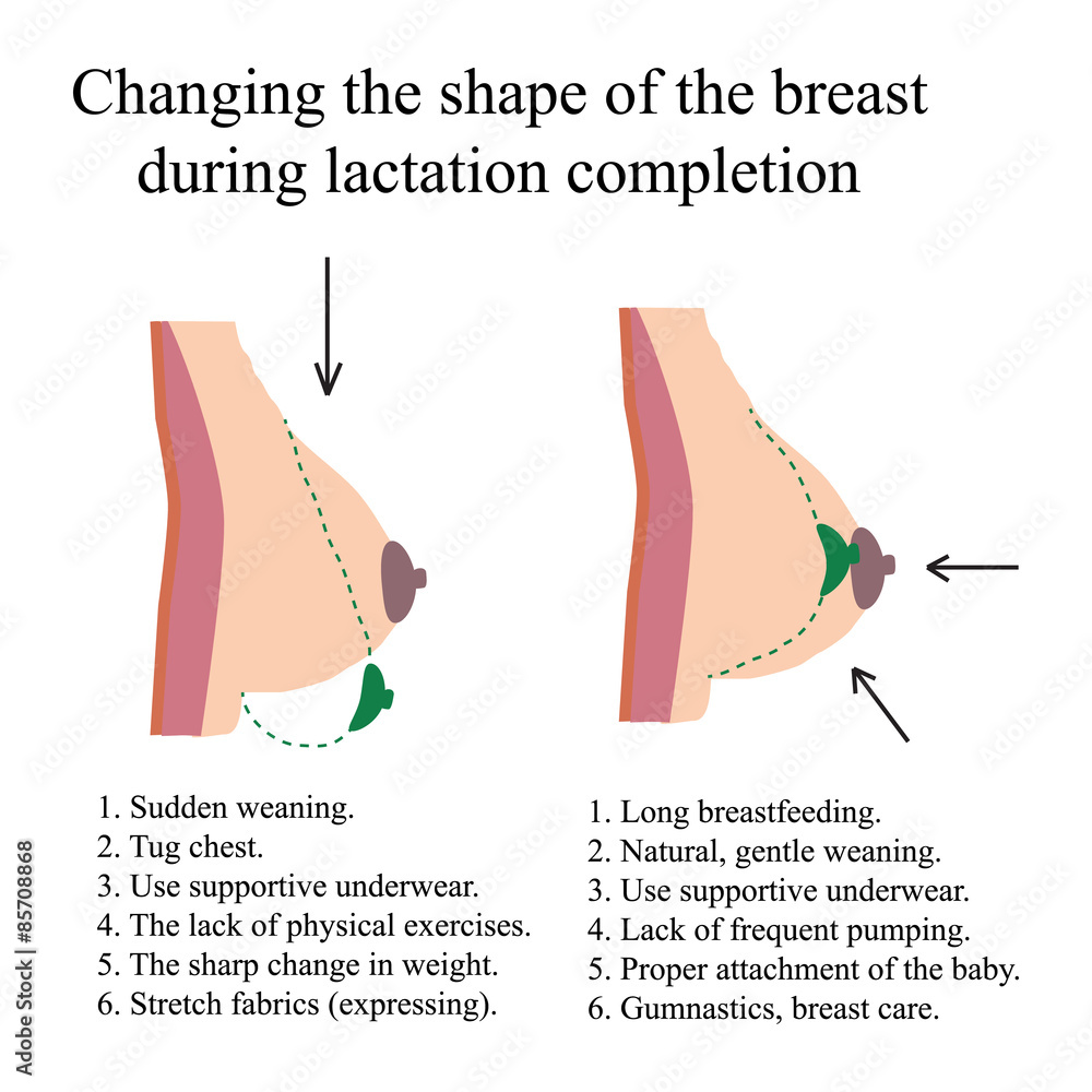 Changing The Shape Of The Breast During Lactation Stock Vector Adobe Stock, Breast Shape Up Exercises