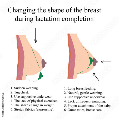Changing the shape of the breast during lactation completion.
