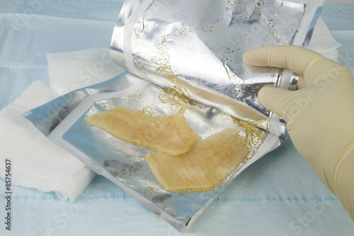 Hydrogel Burn Dressing photo