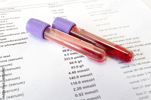 Red blood in test tubes on white blank