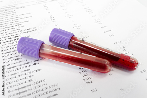Red blood in test tubes on white blank