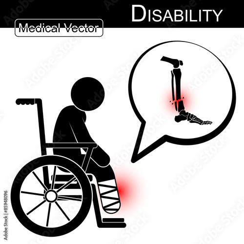 Vector Stick man with leg fracture on wheelchair and text bubble ( Disability , Physical Therapy concept ) ( Flat design ) ( Tibia and Fibular fracture )