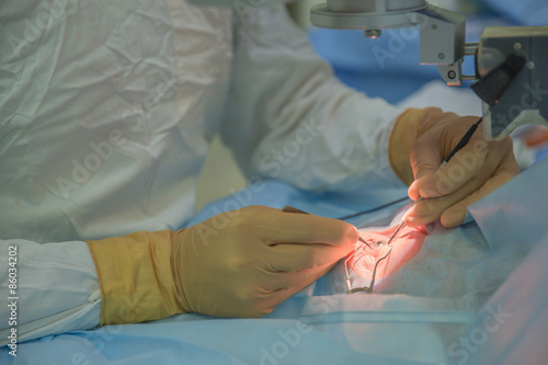 Ophthalmology operation