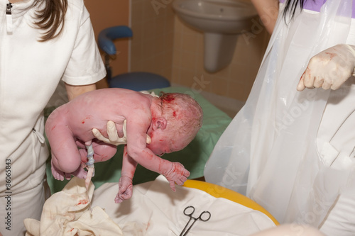 newborn baby during delivery