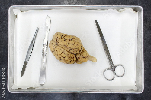 Photos Dissection of a sheep brain