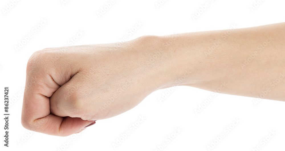 Epidermoid cyst on caucasian female wrist isolated on white. Epidermoid cyst on caucasian female wrist isolated on white.