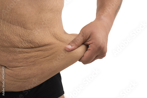 фотографія man with fat belly and stretch marks