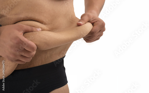 Fotografija man with fat belly and stretch marks