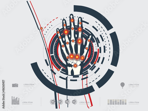 
vector illustration of an arthritic hand