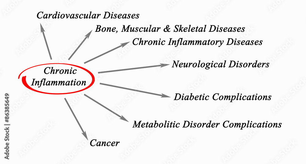 Obraz premium Chronic Inflammation