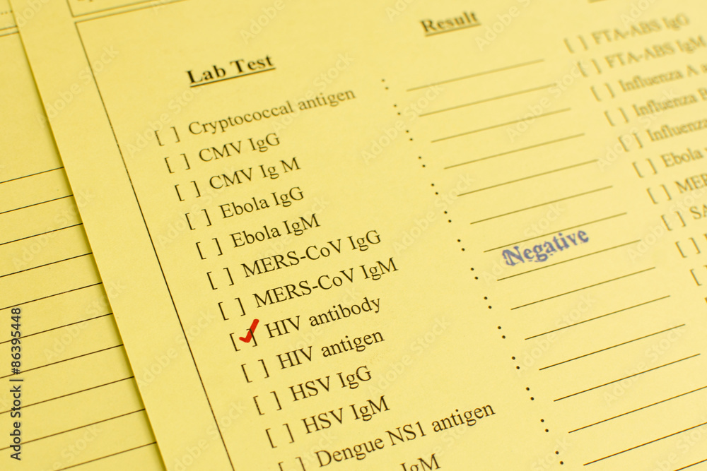 HIV negative HIV negative